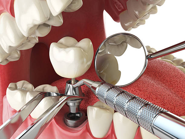 Best Emergency Dental Care for Broken or Chipped Teeth in The Pinehills, MA